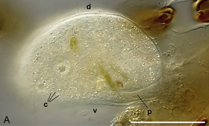 Astroperula dumacki Siemensma &amp; Holzmann, 2023
