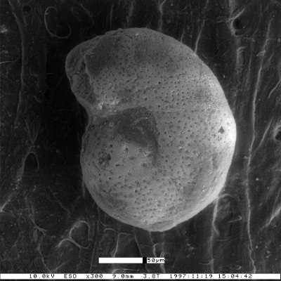 Anomalina regina var. minor Smith, 1957