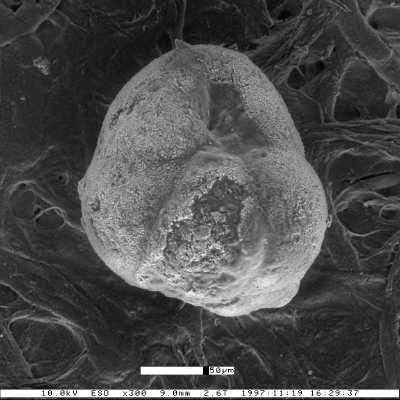 Baggatella californica Mallory, 1959