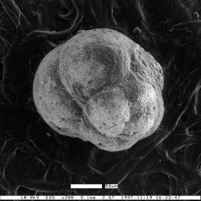 Baggatella californica Mallory, 1959