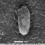 Berthelinopsis carlsbadensis Sliter, 1968