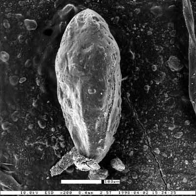 Bulimina kleinpelli Smith, 1957