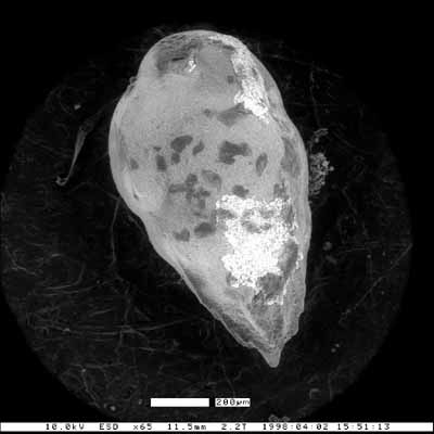 Bulimina sculptilis var. brevis Weaver &amp; Weaver, 1962