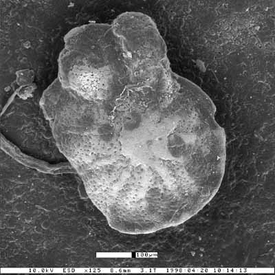 Cibicides ouachitaensis var. alhambrensis Smith, 1957 Cibicides ouachitaensis var. alhambrensis Smith, 1957