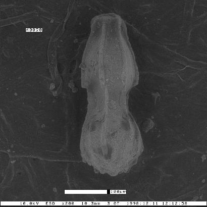 Dentalina spinosa var. ornata Smith, 1957