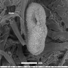 Epistominella nova Garrison, 1959