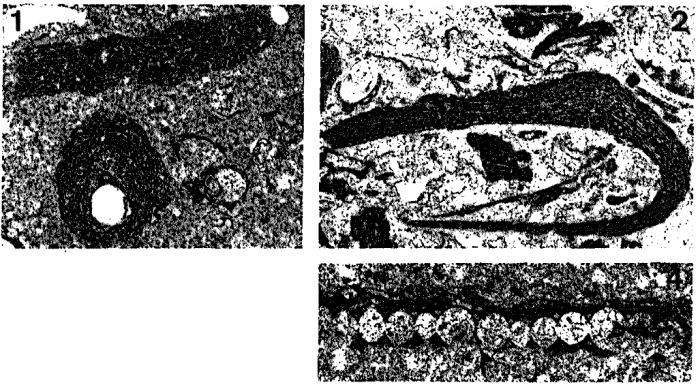 Ellesmerella subparallela (Flügel &amp; Flügel-Kahler, 1980)