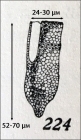 Figure of original description of Poroecus curtus in Kofoid & Campbell 1929