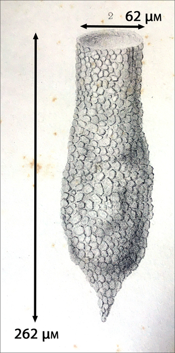 Figure from the original description of Tintinnopsis annulata as Tintinnus annulatus By Claparède &amp; Lachmann 1858
