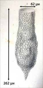 Figure from the original description of Tintinnopsis annulata as Tintinnus annulatus By Claparède & Lachmann 1858
