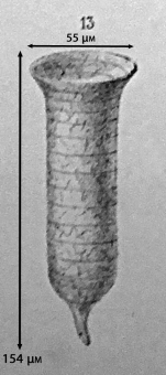 Figure from the original description of Tintinnus cinctus in Claparède & Lachmann 1858 now known as Tintinnopsis cincta