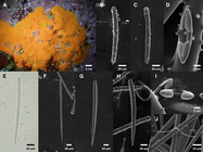 A: field photo of IZC00048433 (see also FIGURe 9a for field photo of IZC00048434). B: choanosomal acanthostyle. C: choanosomal acanthostrongyle. D, I: Chelae. E: ectosomal strongyle. F: ectosomal style. G–H: subectosomal acanthostyles. J: toxa. B–J from IZC00048433.