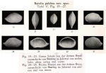 Bairdia pulchra Veen, 1934 from the original description