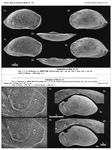 Anchistrocheles eximia Herrig, 1992