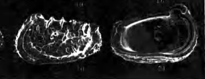 Abyssocythere regalis Zhao in Wang, Zhang, Zhao, Min, Bian, Zheng, Cheng & Chen, 1988 from the original description Abyssocythere regalis Zhao in Wang, Zhang, Zhao, Min, Bian, Zheng, Cheng & Chen, 1988 from the original description