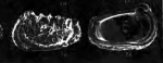Abyssocythere regalis Zhao in Wang, Zhang, Zhao, Min, Bian, Zheng, Cheng & Chen, 1988 from the original description