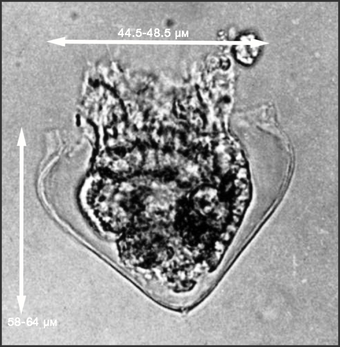 From Lackey &amp; Balech 1966