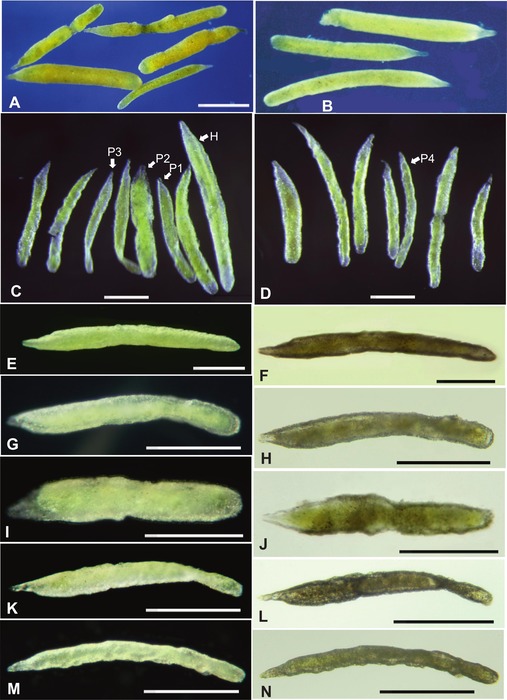 Flaviatella profunda Holzmann, Gooday &amp; Pawlowski, 2025