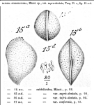 Bairdia supradentata Terquem, 1878 from the original description