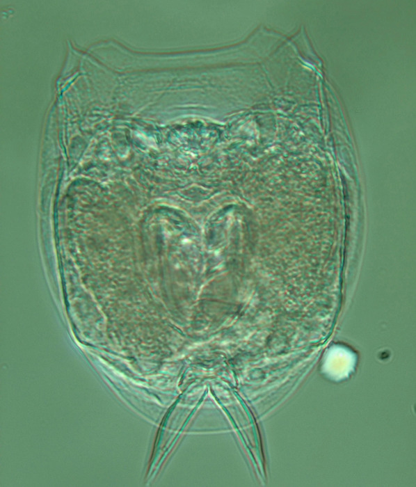 Lecane cf. zhanjiangensis