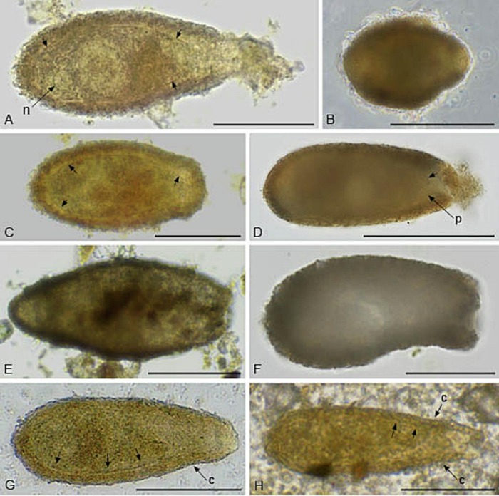 Lacogromia cepelaki Siemensma, Baković &amp; Holzmann, 2025