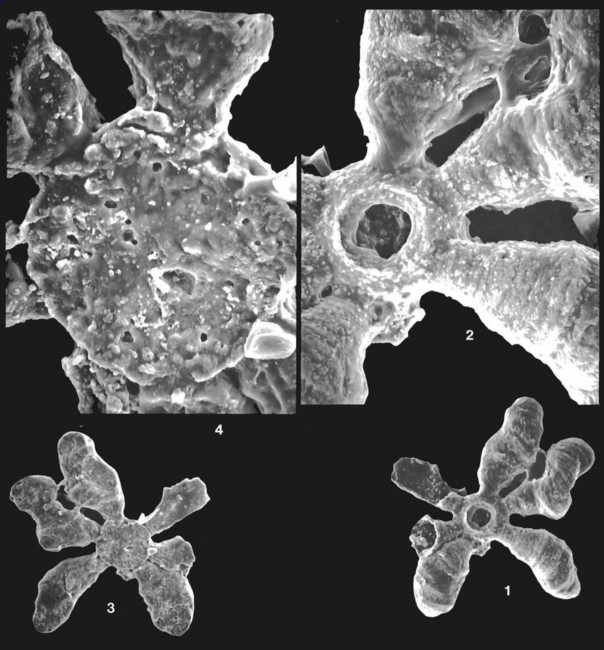 Octonoradiolus polythylakus Loeblich &amp; Tappan, 1994 Holotype