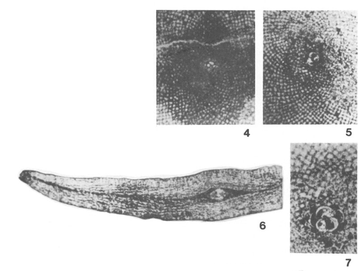 Lepidocyclina (Polylepidina) punjabensis Davies, 1937