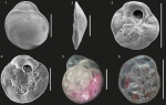 Mullinoides differens McCulloch, 1977 (scale bar: 100 micrometres)
