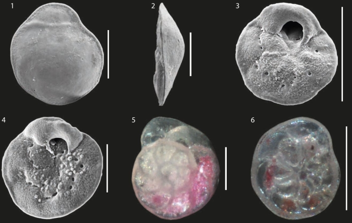Mullinoides differens McCulloch, 1977 (scale bar: 100 micrometres)