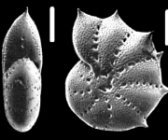 Cribroelphidium spinatum (Cushman and Valentine 1930), unsequenced specimen