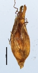Spikelet of Rhynchospora megapotamica Fernández 904 (NY 4239512) Argentina 1