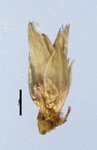 Spikelet of Rhynchospora setigera Smith 7486 (NY 613110) Brazil 1