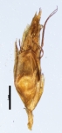 Spikelet of Rhynchospora subtilis Koyama 13676 (NY 05131558 ) Brazil 1