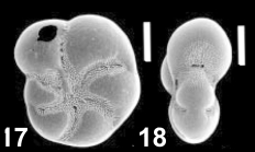 Cryptoelphidiella limpida (Shchedrina in Shchedrina and Lukina 1984), unsequenced specimen, Japan