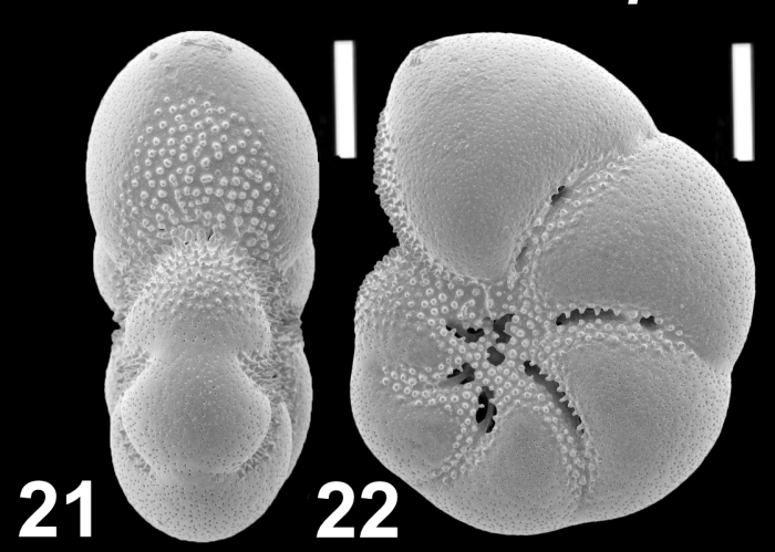 Cryptoelphidiella limpida (Shchedrina in Shchedrina and Lukina 1984), unsequenced specimen, Japan