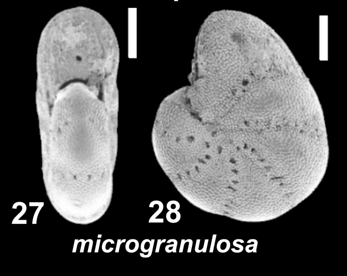 Cryptoelphidiella microgranulosa (Galloway and Wissler 1951), unsequenced specimen, Canada