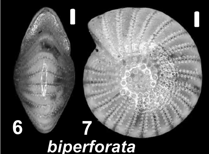 Elphidiella biperforata (Whittaker and Hodgkinson 1979), unsequenced specimen, Singapore