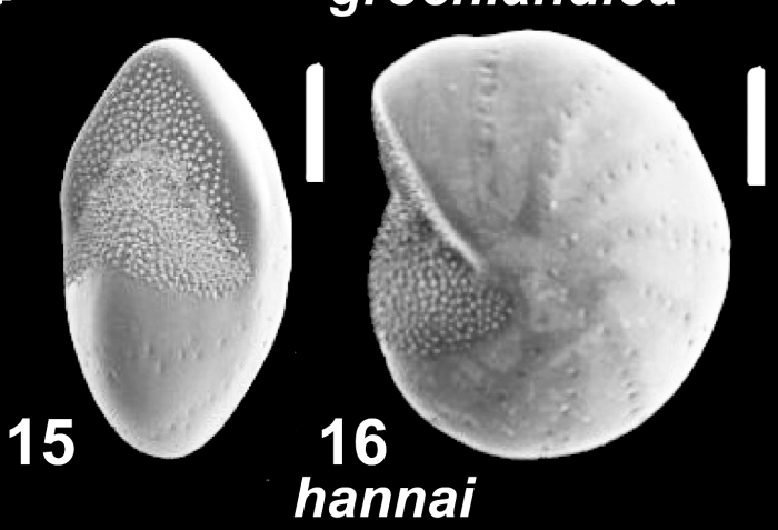 Elphidiella hannai (Cushman and Grant 1927), S43, sequenced specimen