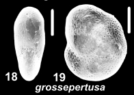Emayerella grossepertusa (Loeblich and Tappan 1994), unsequenced specimen