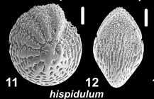 Hispidoelphidium hispidulum (Cushman 1936), unsequenced specimen, India