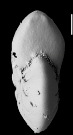 Toddinella darlingae Hayward and Langer 2025, paratype