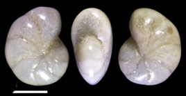 Toddinella matsukawauraensis (Takayanagi 1955), unsequenced specimen, China