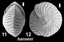 Elphidium hanseni Hayward 2025, holotype