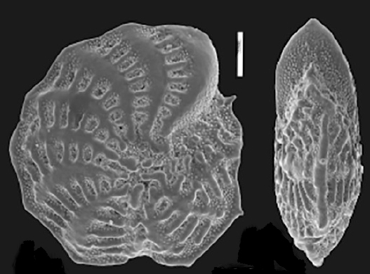 Elphidium korsuni Hayward 2025, holotype
