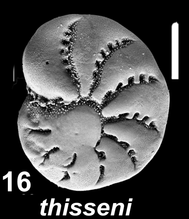 Elphidium thisseni Hayward and Langer 2025, paratype