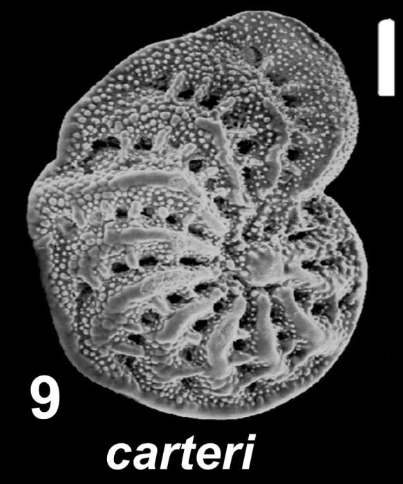Elphidium carteri Hayward in Hayward et al. 1997, paratype