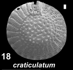 Elphidium craticulatum (Fichtel and Moll 1798), unsequenced specimen, Saudi Arabia, 