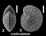 Elphidium craticulatum (Fichtel and Moll 1798), unsequenced juvenile specimen, Oman