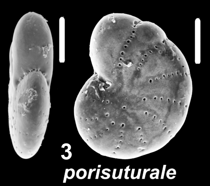 Elphidium porisuturale (Zheng 1978), unsequenced specimen, Indonesia
