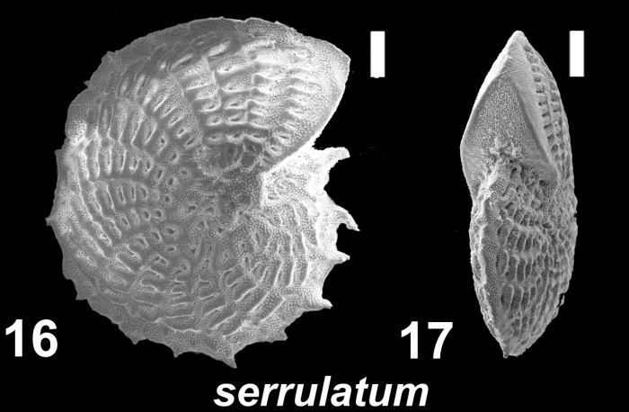Elphidium serrulatum Cushman and Parker 1931, unsequenced specimen, Kerguelen Is